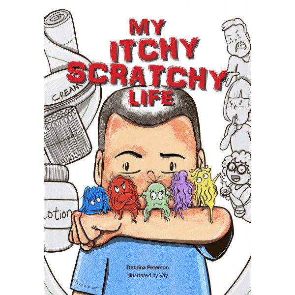 My Itchy Scratchy Life